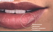 Compeed-пластырь помогает лечит и маскировать герпетическое высыпание-