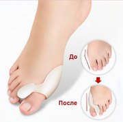Фиксатор для косточки на ноге Valgus Plus c 50% скидкой!